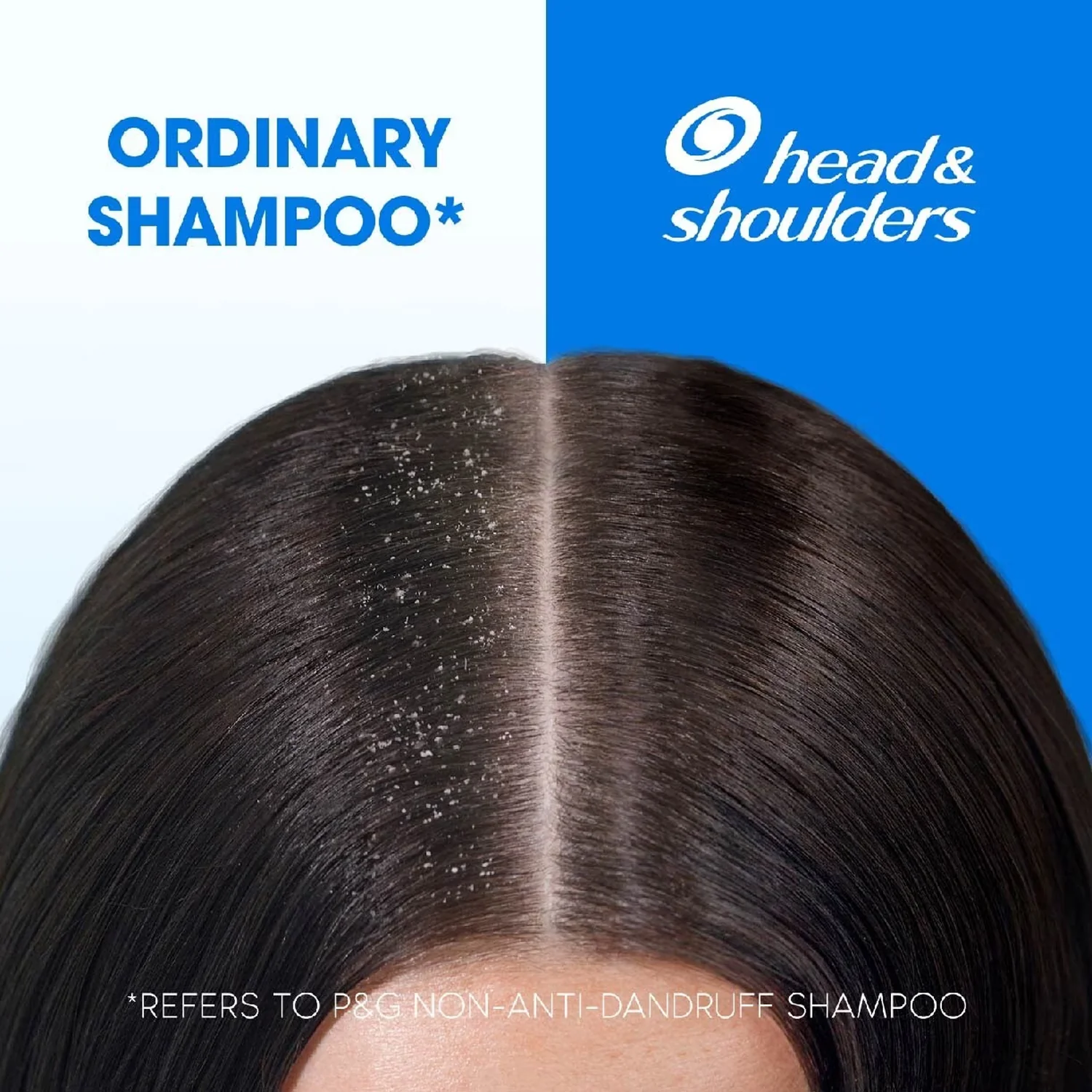 H&S Shampoo Itchy Scalp 720Ml - Image 2